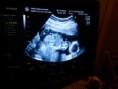 /album/mundo-ecografico/a2012-01-18-14-41-37-jpg/